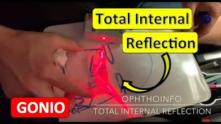 Total Internal Reflection - LASER DEMO!