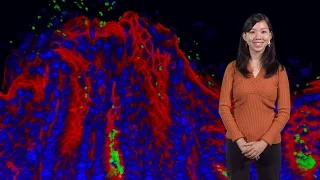 Julie Huang (Stanford U.): H. pylori finds its home