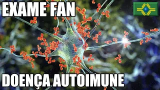 EXAME FAN | DOENÇA REUMÁTICA | LUPUS | DOENÇA AUTOIMUNE