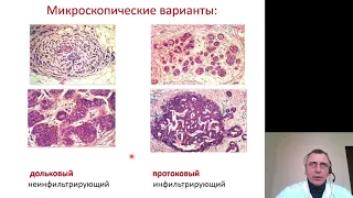 Патанатомия 13. Заболевания женских половых органов и молочных желез