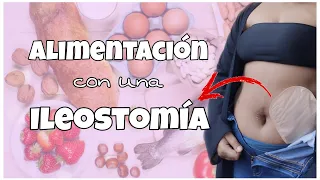 Ostomía :  Ileostomía y como evacuar menos con los Alimentos // Mini video