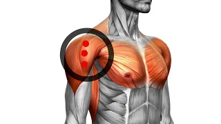 Exploring the Deltoids: Understanding Trigger Point Locations for Better Muscle Health