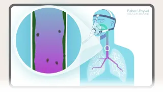 How does humidity support the lungs? | F&P Healthcare