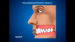 Типы прикусов, выделяемые в стоматологии
