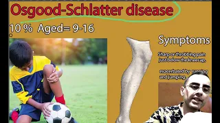 Osgood-Schlatter disease - symptoms, causes and treatment