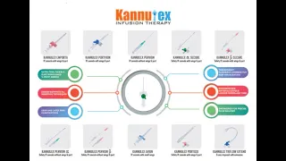 Types of IV cannula