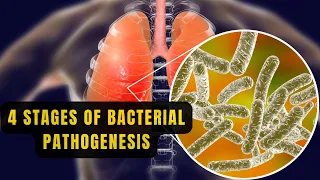 Bacterial Pathogenesis || 4 Stages and Mechanism of Bacterial Pathogenesis