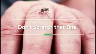 To Your Health Quick Takes: Don't Scratch That Bite!