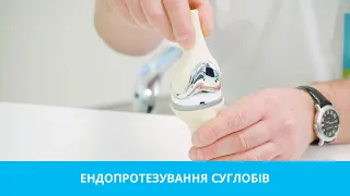 Эндопротезирование