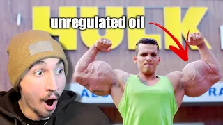 This Bodybuilder has FAKE Muscles!