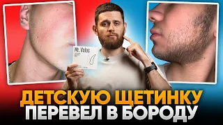 За 3 месяца зарастил бороду в 19 лет / Результаты mr.Volos для роста бороды