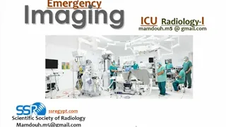 15- Role of imaging in chest ICU (II) Prof. Mamdouh Mahfouz