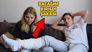 ANNEME BACAĞIM KIRILDI ŞAKASI !! (ÇOK KORKTU)