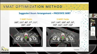 IMRT 2.0 | Session 17 | IMRT Treatment Planning: The “Shulman” VMAT Optimization Method