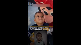 Shocked child in viral video from Gaza makes a recovery | AJ #shorts