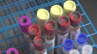 New Blood Test Could Help Prevent Heart Attack and Stroke