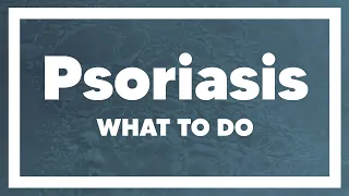 Remove Psoriasis Naturally : Yes, you can