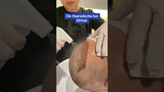 Komme jetzt zu Elithair und lasse Deinen Kopf, nach Deiner Haartransplantation, von uns waschen 🧼👀