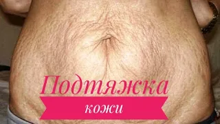 ПОДТЯЖКА КОЖИ после похудения и не только!