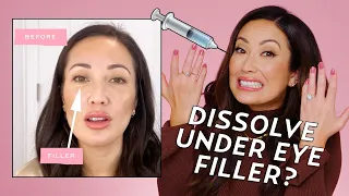 Why I Dissolved My Under Eye Filler | Skincare with Susan Yara