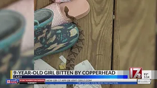Copperhead bite