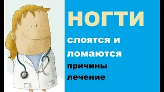 Ногти слоятся и ломаются: причины проблемы и лечение