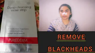 |Best way to remove Blackheads |Clean Nose With Easy HOW TO MAKE PORE STRIPS WORK BETTER BLACKHEADS