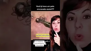 Você já teve pelo encravado