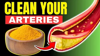 Top 7 Foods That Unclog Arteries Naturally and Prevent Heart Attacks