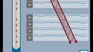 Gastroenterology: Ohmega Total Reflux Monitoring CD "Part 1: What is Impedance?"