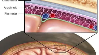 CNS Infections ( Meningitis part 1 ) 2023