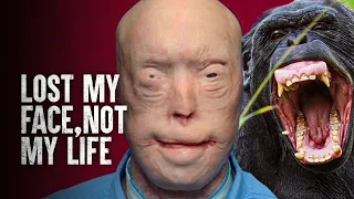 How I Survived a Chimpanzee Attack