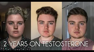 2 YEARS ON TESTOSTERONE // FTM Transgender transition australia