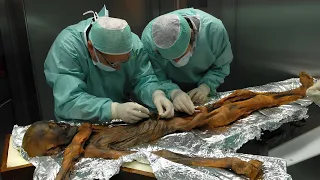 Scientists Finally Study Ötzi the Iceman's Gut And Discover New Fungus