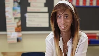 La historia de Lizzie Velasquez