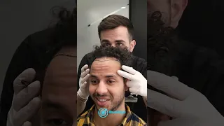 Hair Transplant Surgery in Istanbul, Turkey