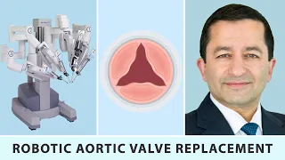 Robotic Aortic Valve Replacement: A Heart Valve Innovation with Dr. Vinay Badhwar