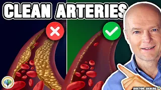 Top 10 Foods To Unclog Arteries Naturally & Prevent Heart Attack