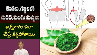 Home Remedy for Skin Diseases | Reduces Eczema and Dermatitis | Rashes | Dr. Manthena's Health Tips