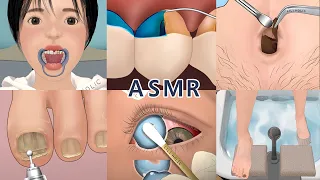 ASMR care collection animation 1 (no music)  | belly, foot, teeth, eye  | 배꼽, 발, 치아, 눈