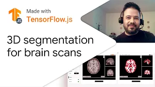 3D MRI brain segmentation - Made with TensorFlow.js