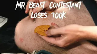 Mr Beast Contestant Loses 700K 😓