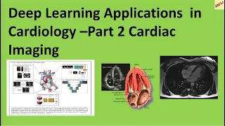 Deep Learning Applications in Cardiology - Part2 Cardiac Imaging #deeplearning