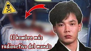 LA DOLOROSA MUERTE DE HISASHI OUCHI (El hombre mas radioactivo del mundo) ☢