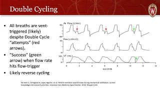 Dyssynchrony!  Thinking Simple - Ventilator Modes, Part 3