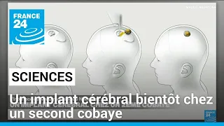 Neuralink : un implant cérébral bientôt chez un second cobaye • FRANCE 24