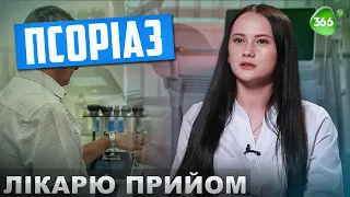 Що Таке Псоріаз? Чому З’являється Псоріаз? Які симптоми Захворювання та як Його Лікувати?