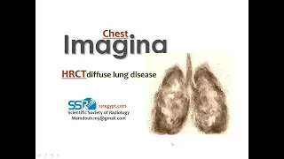 4  Diagnosis of diffuse lung disease, x ray and HRCT(I) Prof. Mamdouh Mahfouz
