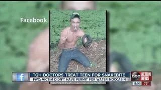 Teen bitten in face by poisonous water moccasin