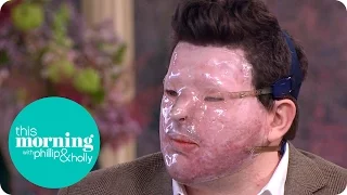 Andreas Christopheros Describes Horrific Acid Attack | This Morning